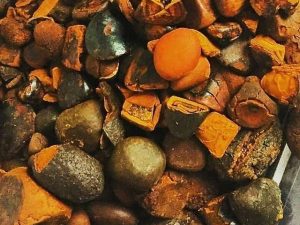 Cathel gallstone